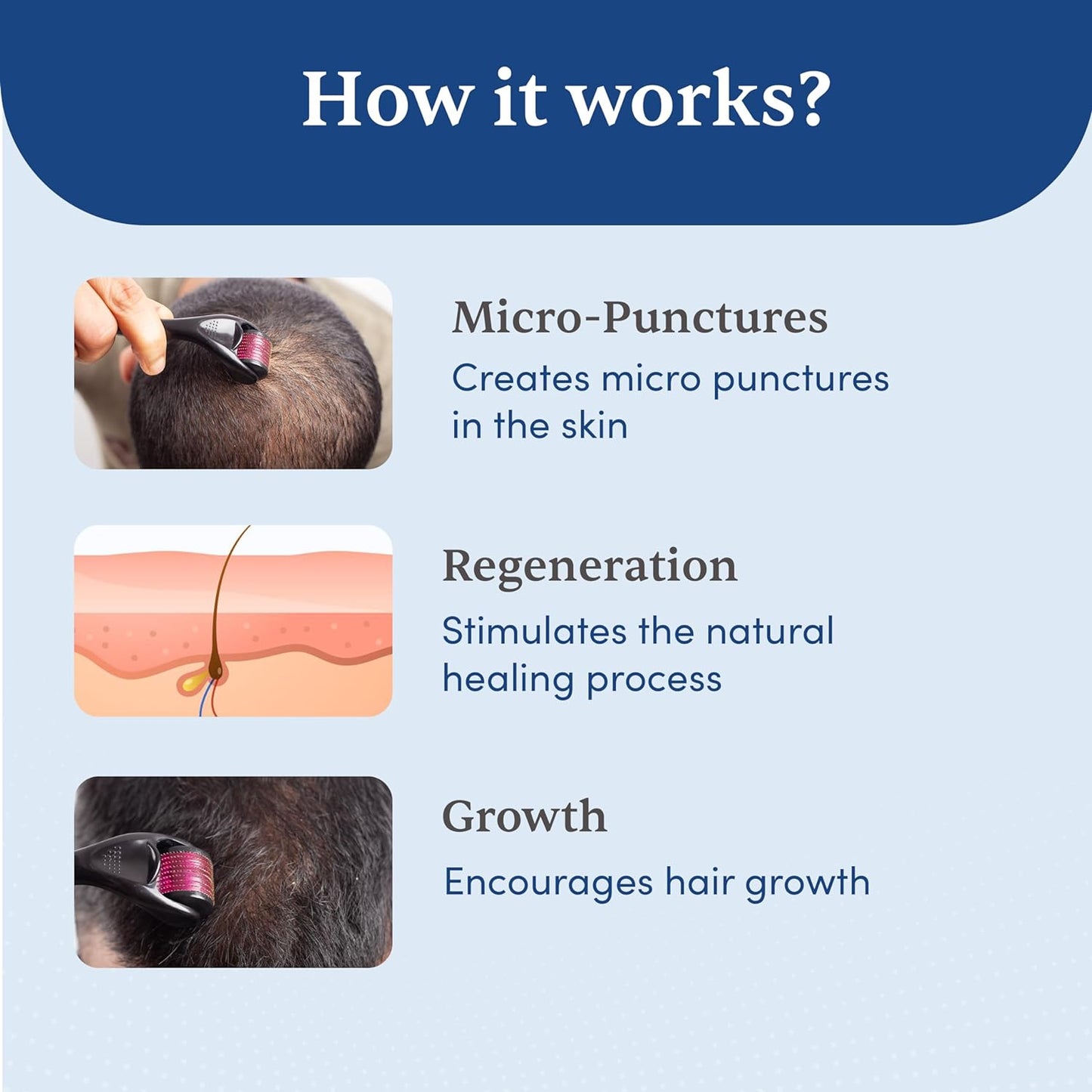 Derma roller 1.00 mm With 540 Titanium Alloy Needles | Promotes Beard Growth & Reduces Acne Scars | Safe & Effective To Use